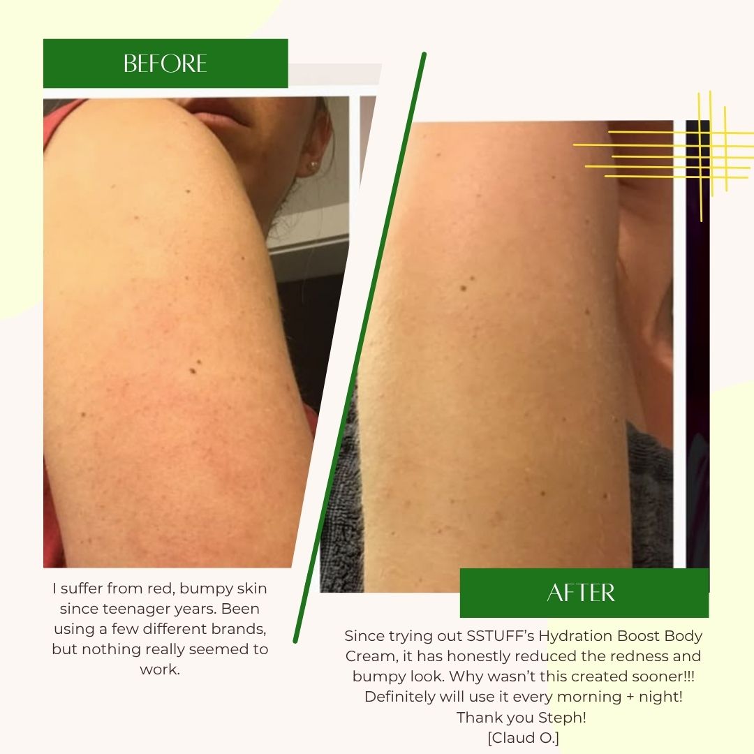 Hydration Boost Body Cream