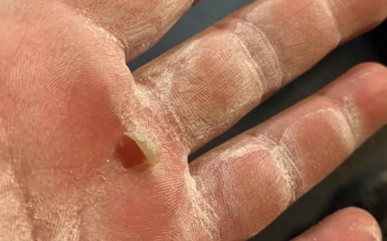 Skin Rip Hand 4 Ways To Avoid Hand Rips During CrossFit – SSTUFF Repair Australia